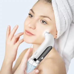 Electric Blackhead Remover Vacuum Pore Cleaner
